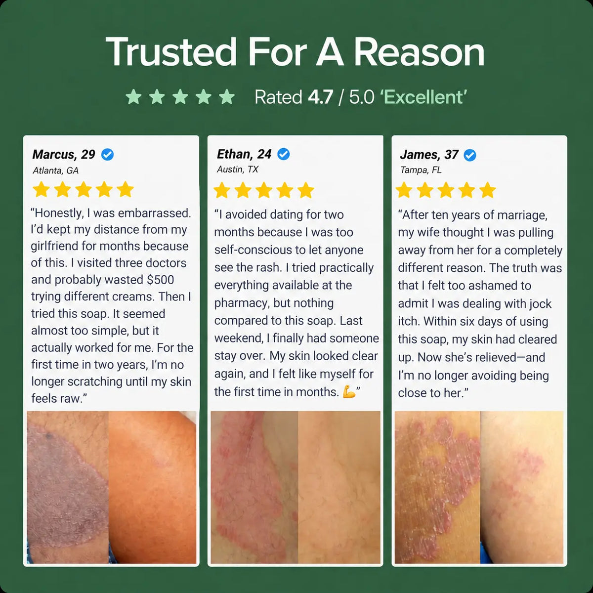 Revota Labs | Antifungal Cleansing Bar