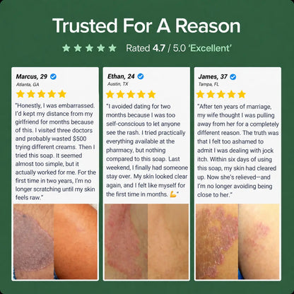 Revota Labs | Antifungal Cleansing Bar